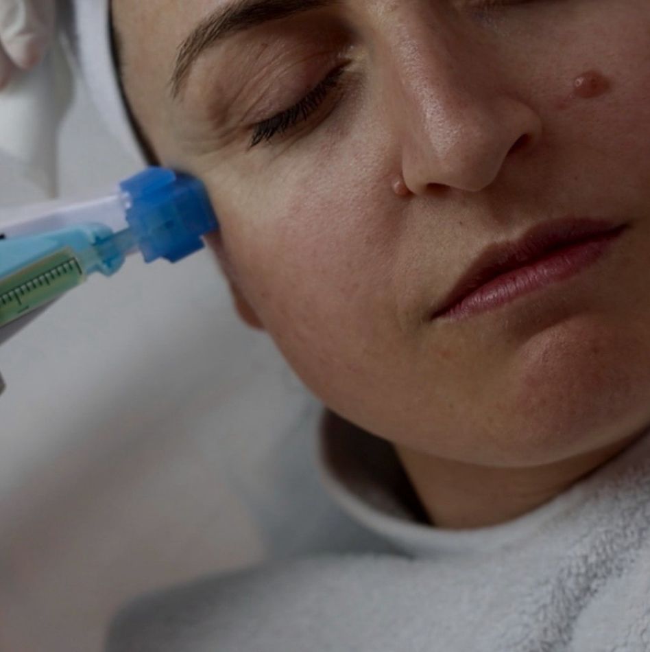 Mesotherapie